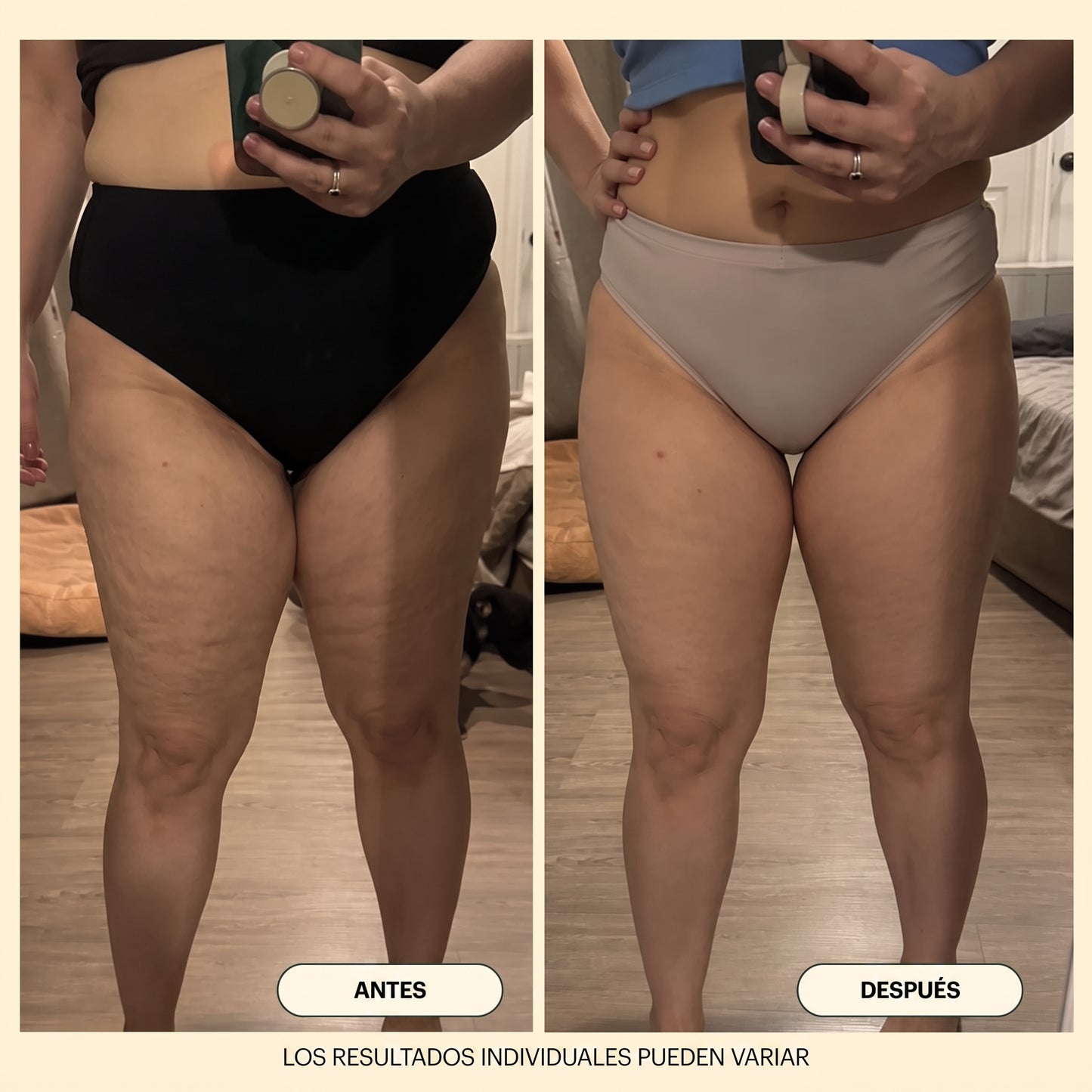 NØRD BODY – Aceite Corporal Anticelulitis y Antiflacidez