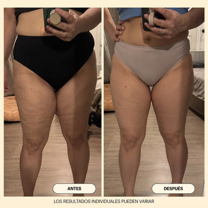 NØRD BODY – Aceite Corporal Anticelulitis y Antiflacidez