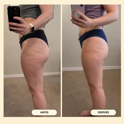 NØRD BODY – Aceite Corporal Anticelulitis y Antiflacidez